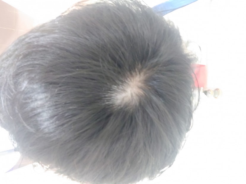 1번 사진을 찍고 몇 초 안 지나 또 찍은 사진