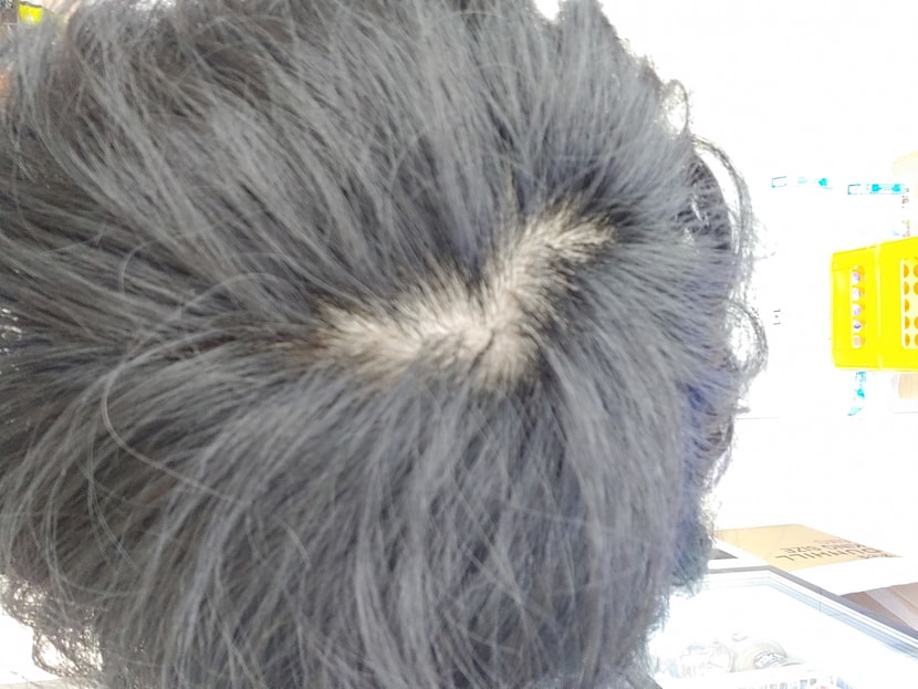 머리를 안 감았을 때 찍은 사진2