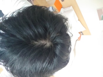 머리를 안 감았을 때 찍은 사진1