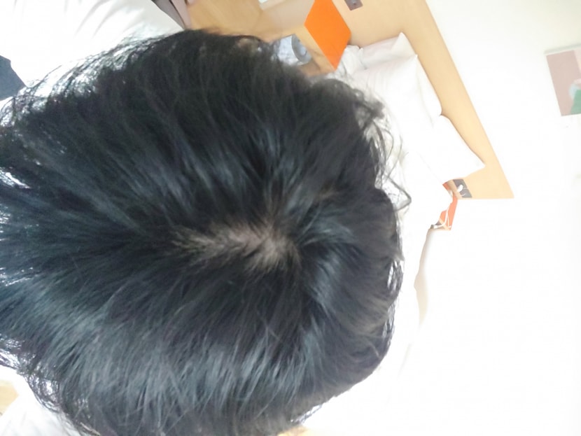 머리를 안 감았을 때 찍은 사진1