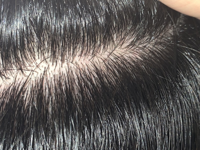 연모화가 너무 진행되는 것 같네요