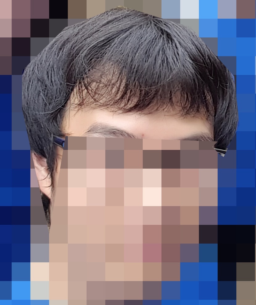 2015년 9월 BEFORE