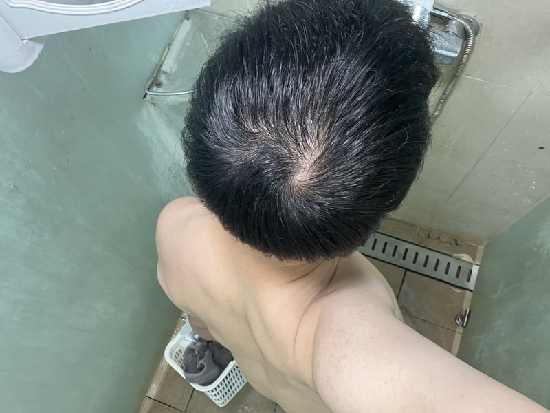 조합약 중단 후기