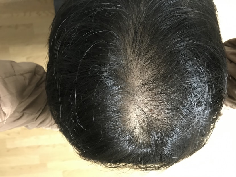 방금 찍은 사진이에요. 가르마 타지도록 일부로 갈라지게 말렸어요.