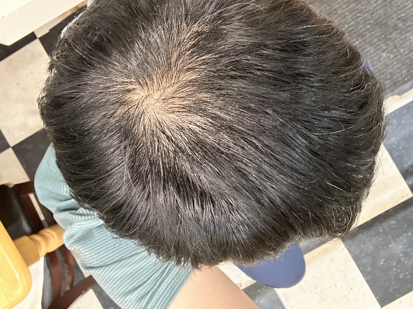 불빛바로 아래서