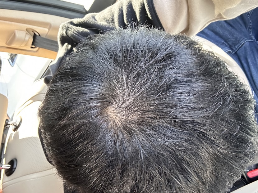 보통 형광등 실냬