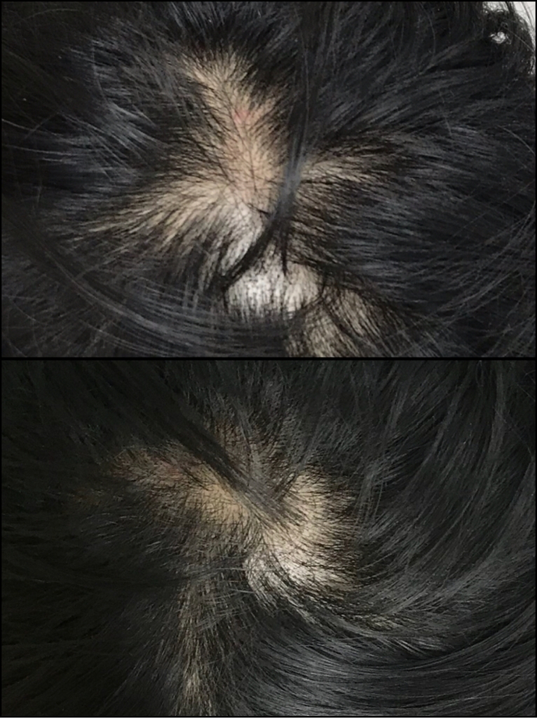 근접샷1