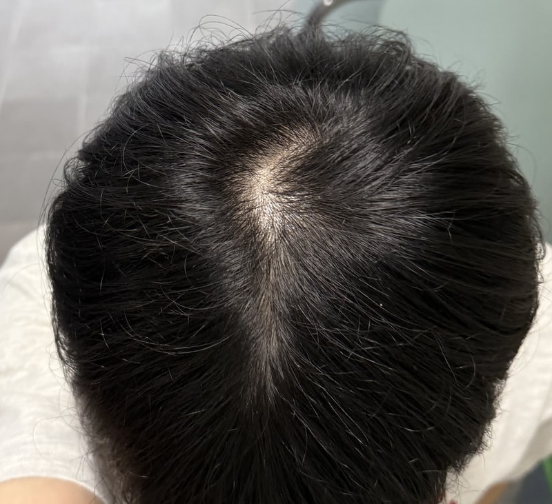 인정하고 병원 다녀왔어요