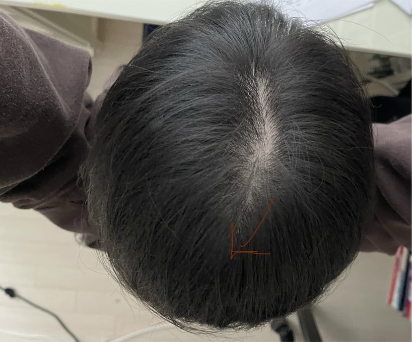 화살표 방향으로 가마가 있기는 합니다..
