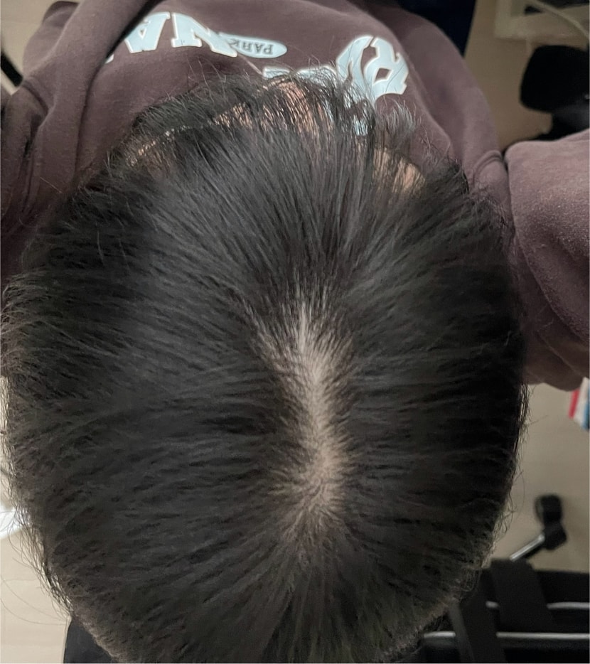 낮에 블라인드 치고 불 끔