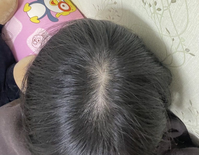 형광등 밑