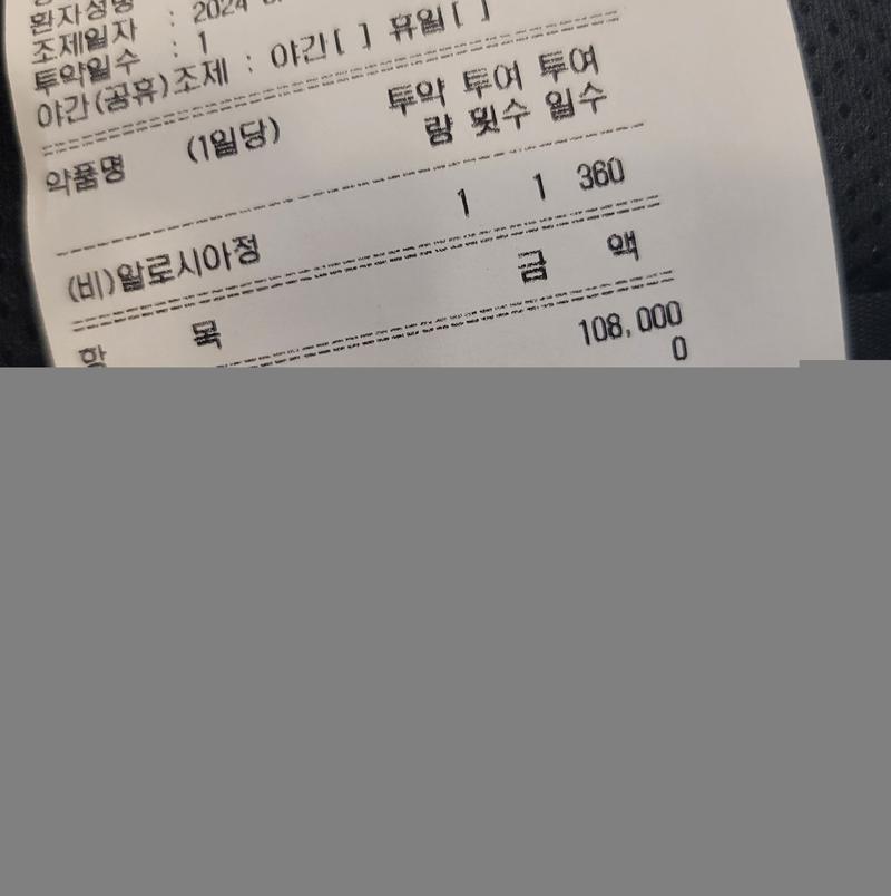 종로갈 필요가 없네 (강남 탈모 성지)