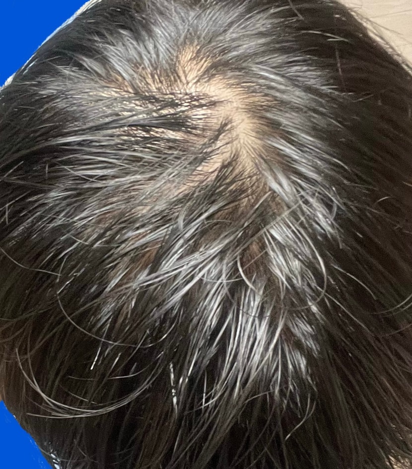 현재 물 묻힌 정수리 상태