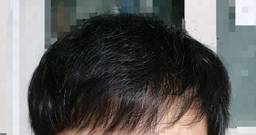 최근