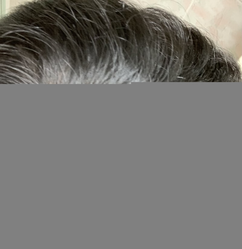 아보다트로 넘어가야 할까요 ....ㅜㅜ