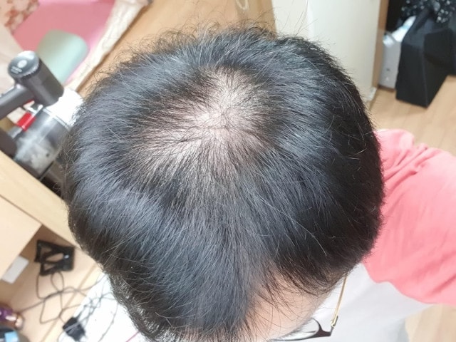 2020년 12월 복용 시작시