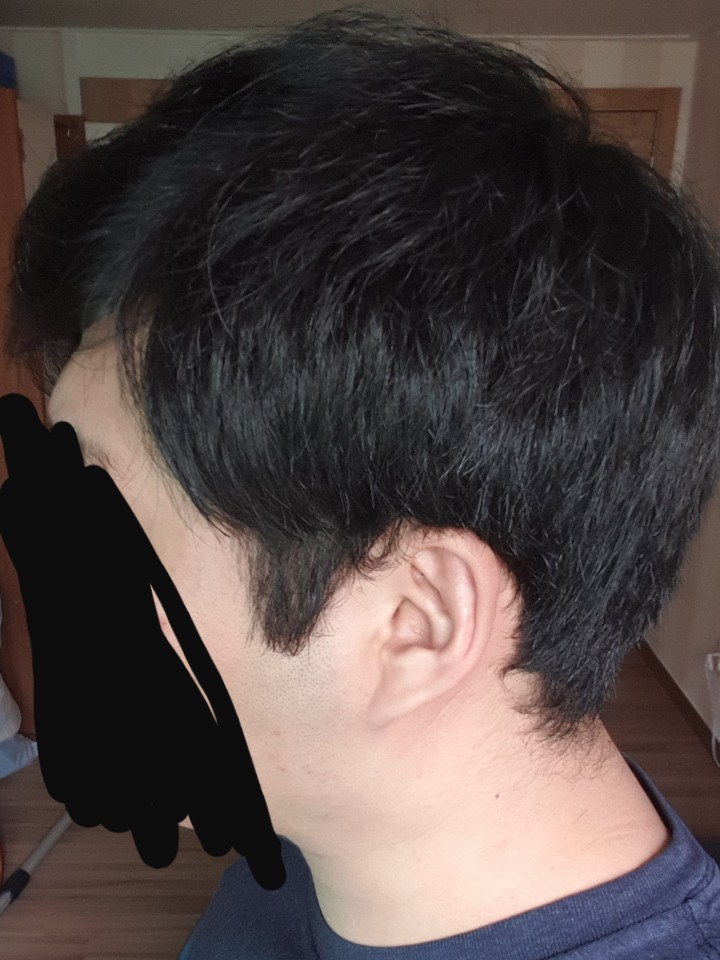 옆머리
