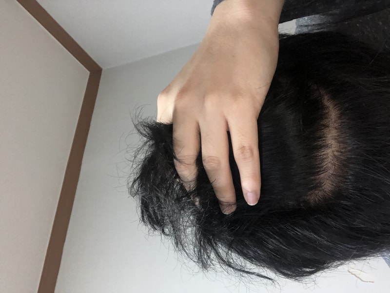 와 아보다트 효과 짱이네요 ㅋㅋㅋ