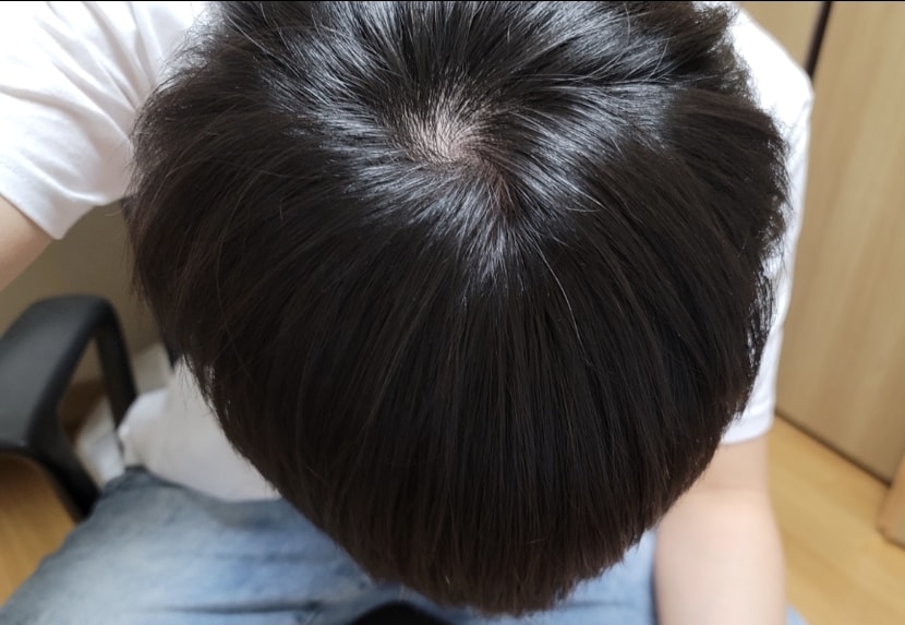 정수리...