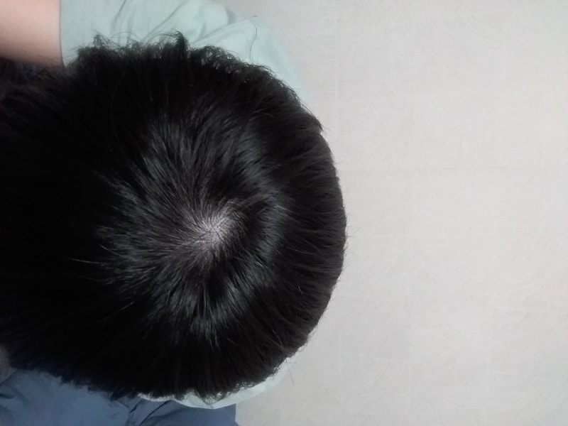 정수리좀 봐주세요....