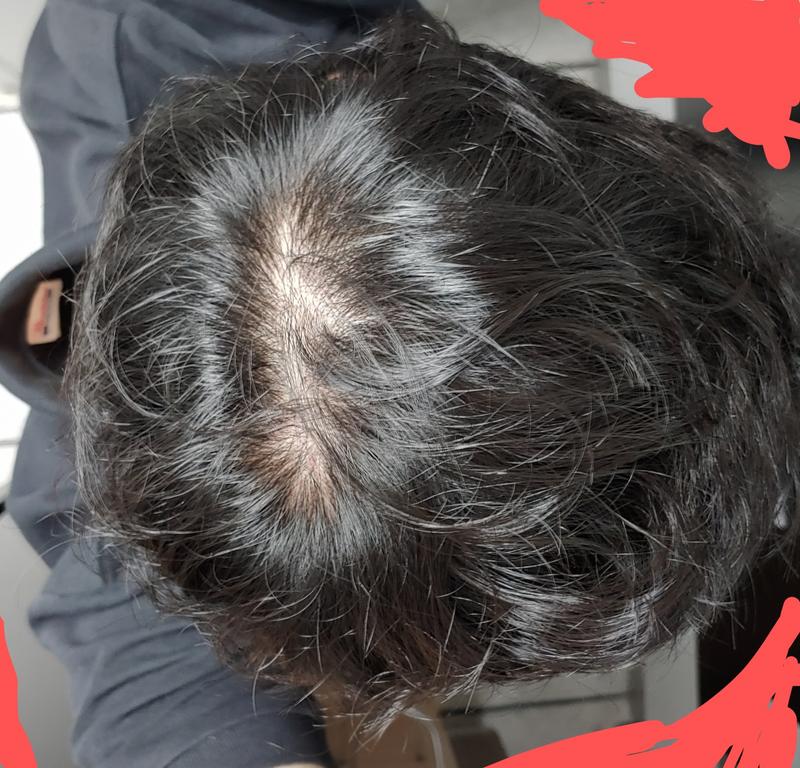 35살입니다. 몰랐는데 벌써...이정도로