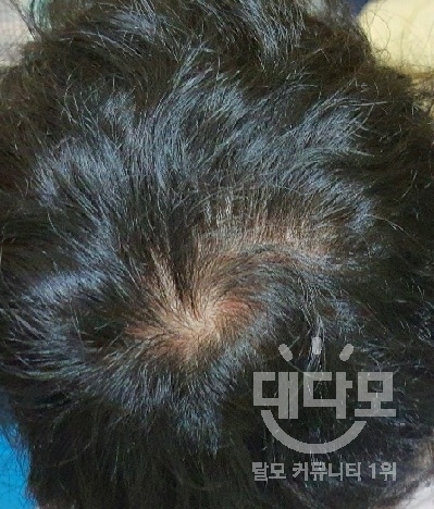 바르기전