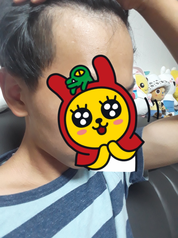 이마가넓습니다 제가말하긴좀 자만이지만 얼굴이작아서 이마가부각됩니다