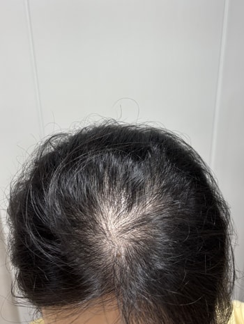 불빛 아래서 사진 찍고 쇼크먹음.. 