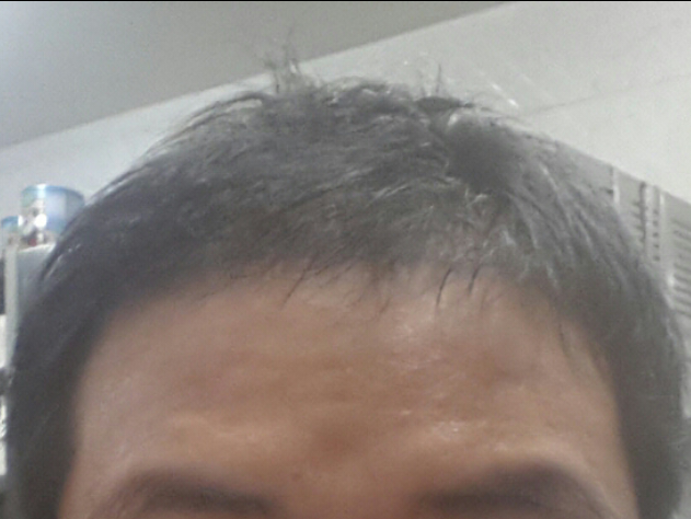 복용전