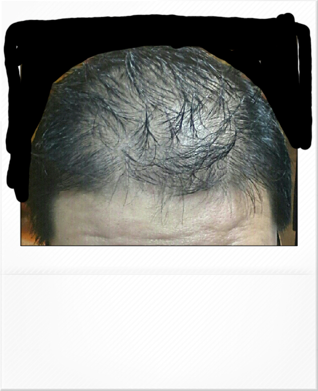 예전모습ㅜㅜ