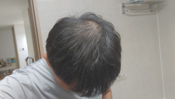 현재 상태입니다.