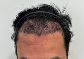후