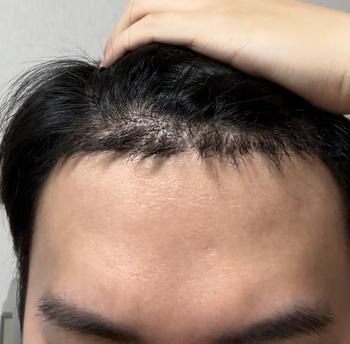 수술후