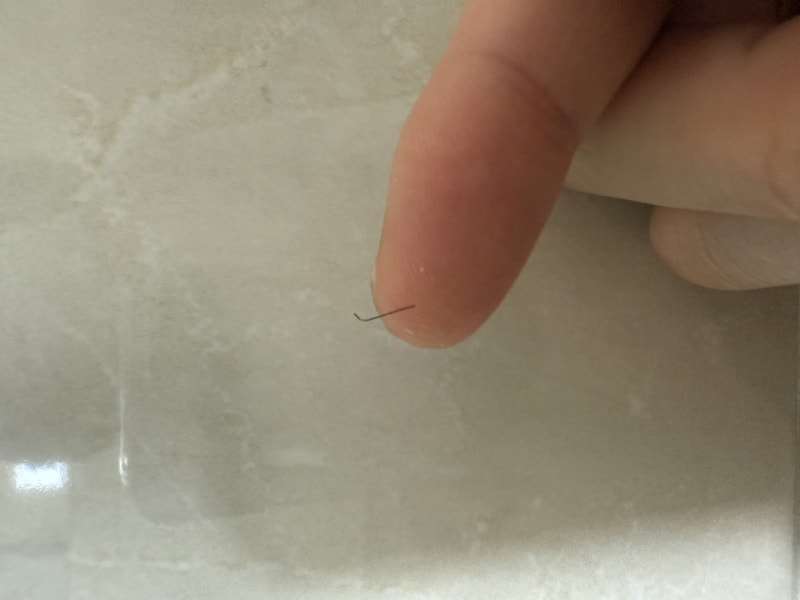 hair after hair transplantation