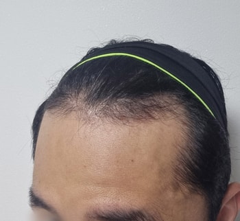 전
