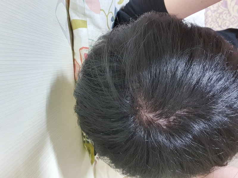 아보다트계열 직구 어떤가요?