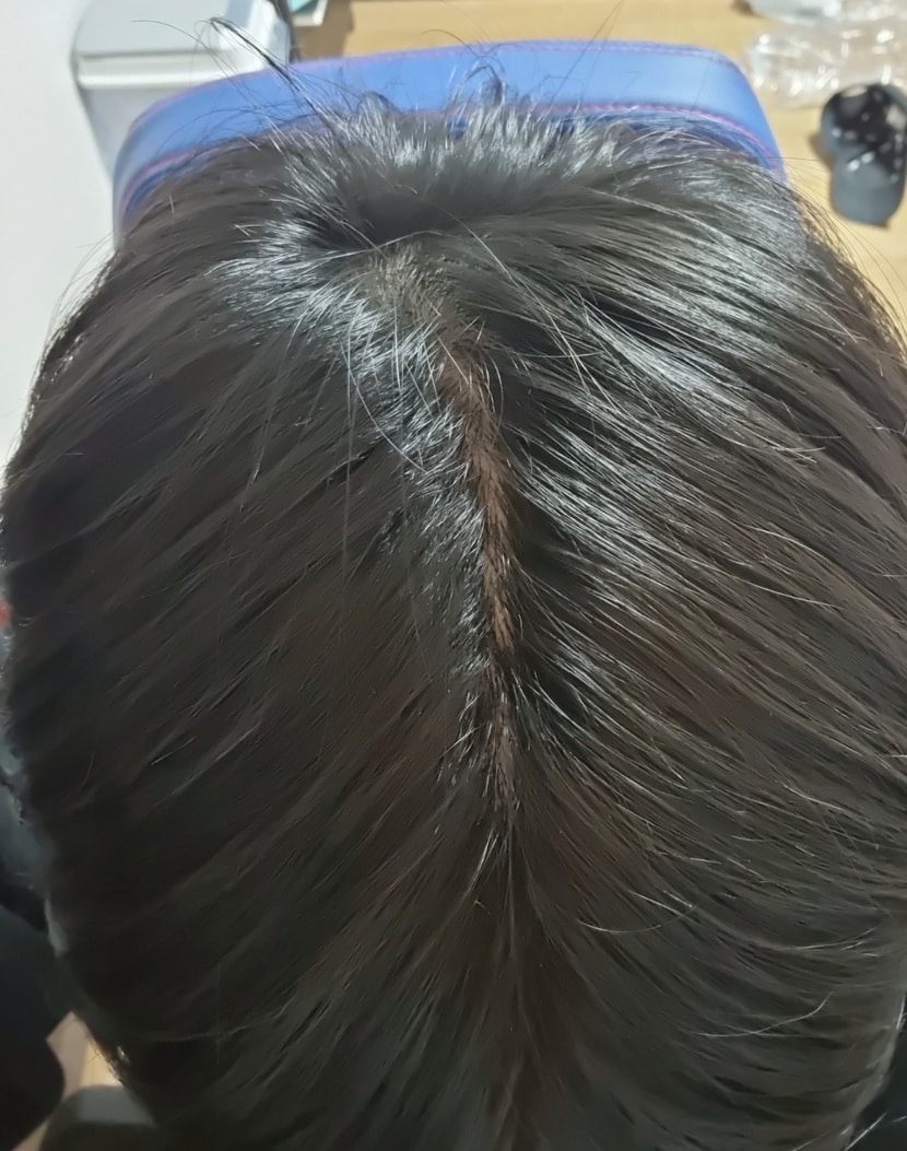 머리감고