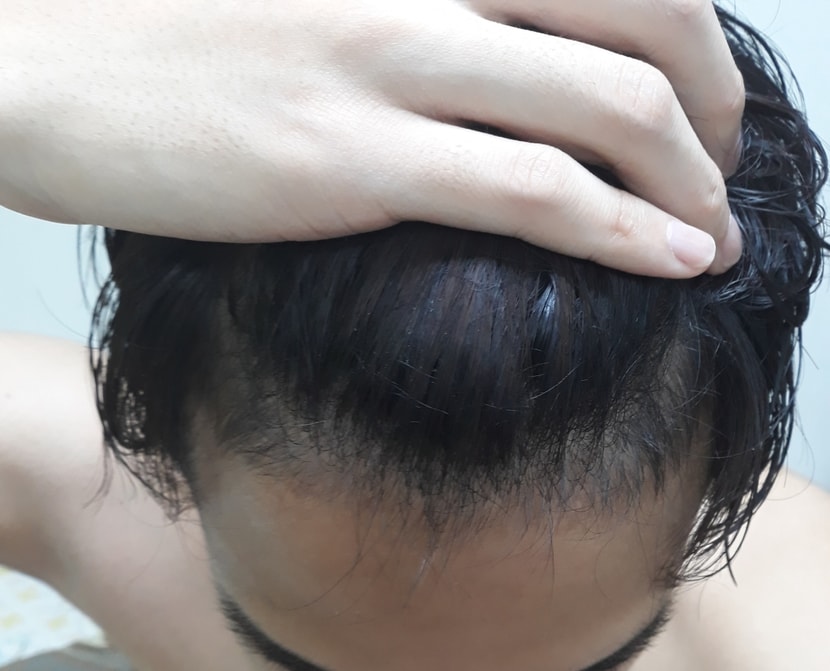 현재1