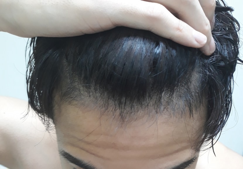 현재2