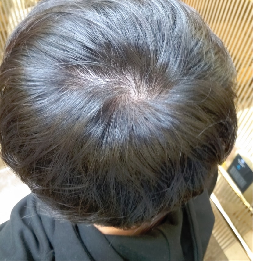 왼쪽이 우측 두상