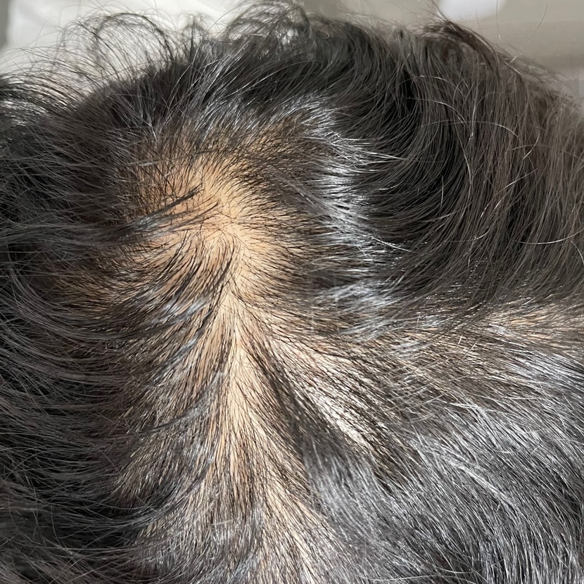 첫번째 방법 사용 후