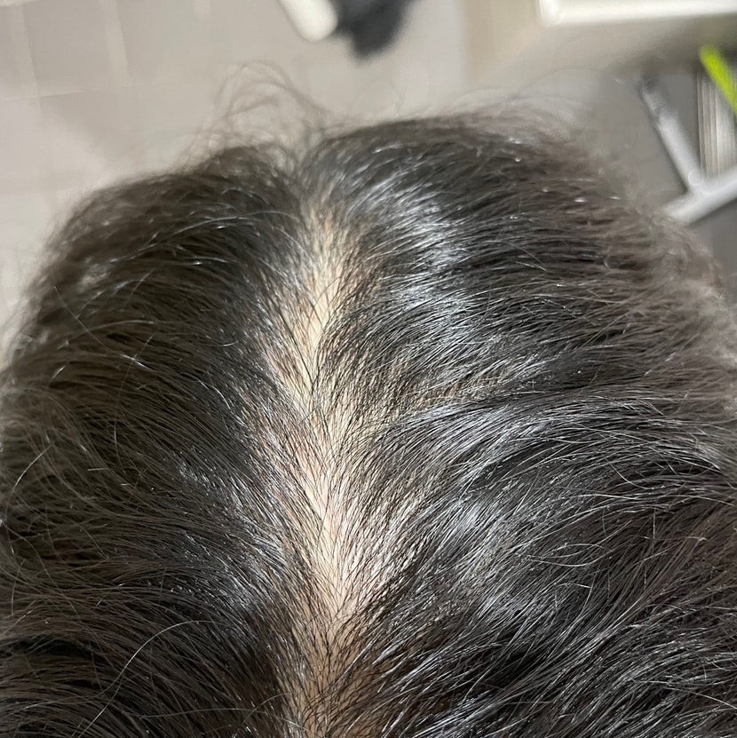 두번째 방법 사용 후