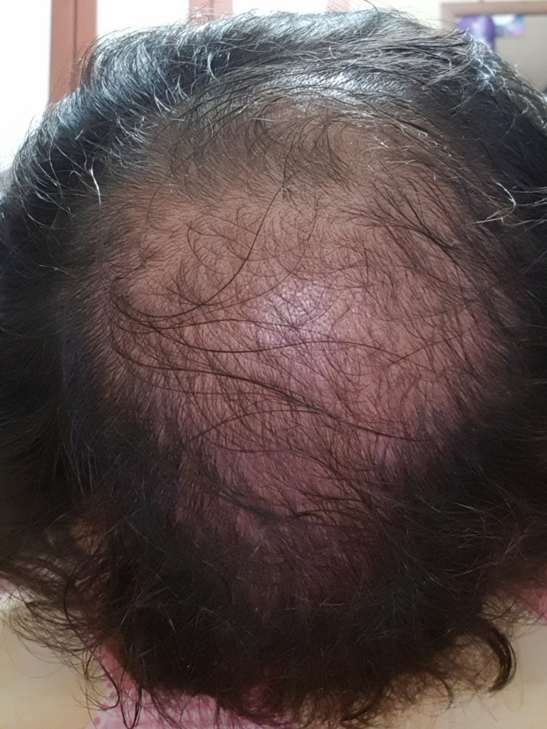최근