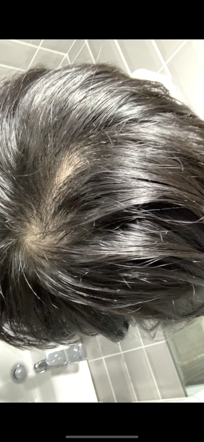 하… 정수리가 너무 답답합니다