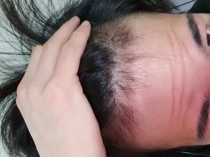 앞