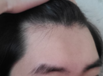 정면 쭉 당겼을 때 좌측