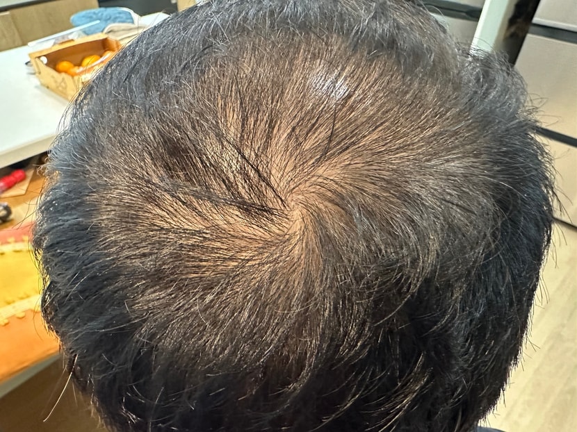 일주일지난 현재