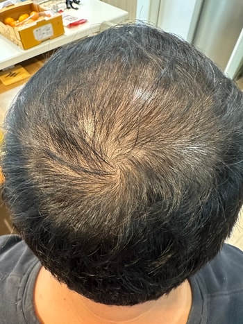 일주일지난 현재