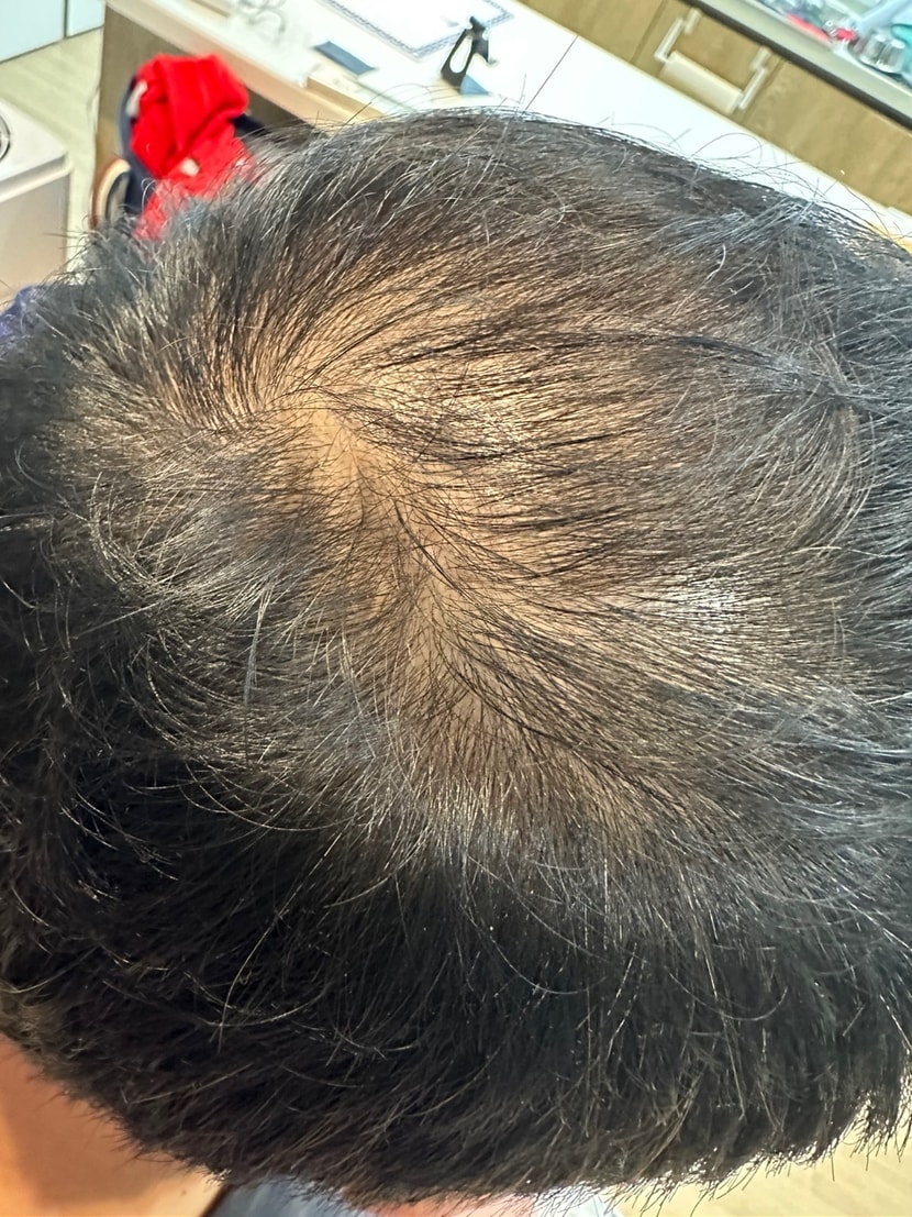 일주일지난 현재