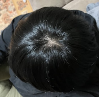 후면카메라